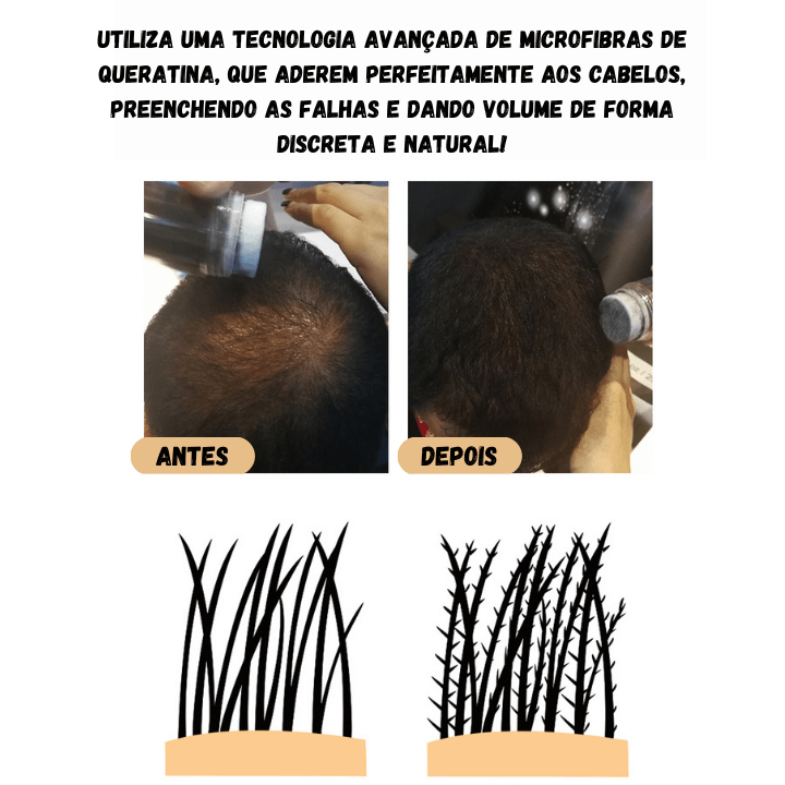 Fibra Capilar Hair FIVVE®.