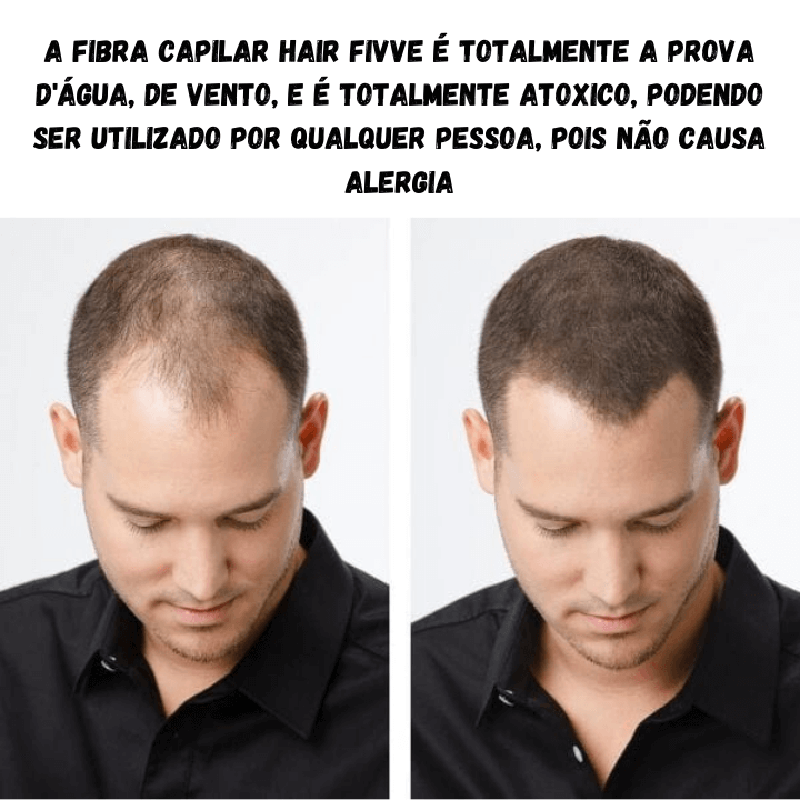 Fibra Capilar Hair FIVVE®.