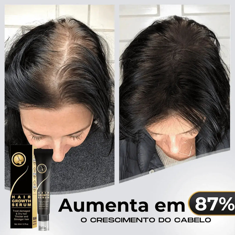 Diminui Queda 95% Aumenta Crescimento 20x  | Repair Hair® | PAGUE 1 LEVE 2