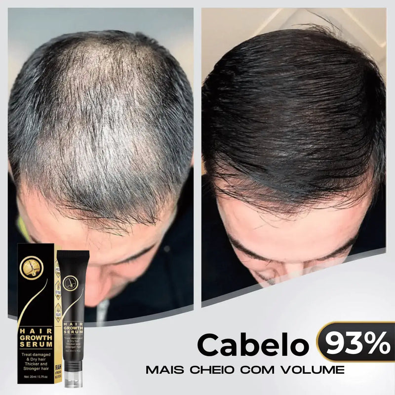 Diminui Queda 95% Aumenta Crescimento 20x  | Repair Hair® | PAGUE 1 LEVE 2