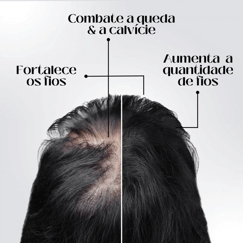 Diminui Queda 95% Aumenta Crescimento 20x  | Repair Hair® | PAGUE 1 LEVE 2