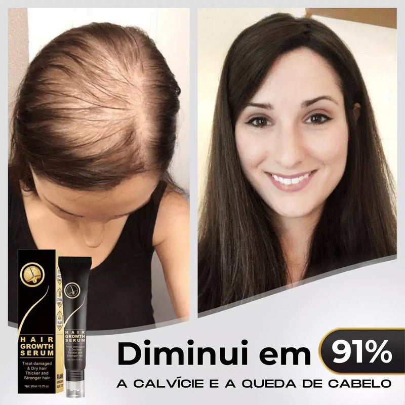 Diminui Queda 95% Aumenta Crescimento 20x  | Repair Hair® | PAGUE 1 LEVE 2