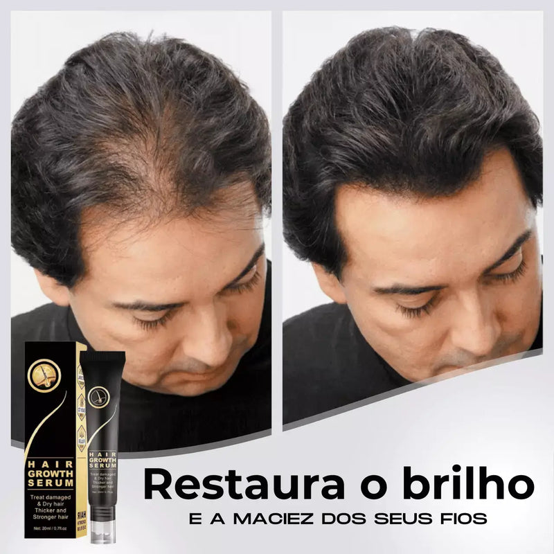 Diminui Queda 95% Aumenta Crescimento 20x  | Repair Hair® | PAGUE 1 LEVE 2